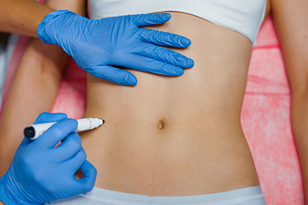 Body fillers injections in Dubai