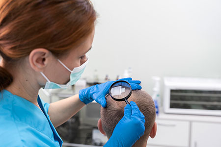 Regenera Activa treatment for hair loss in Dubai