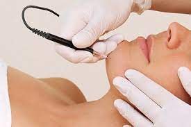 Electrolysis permanent hair removal treatment